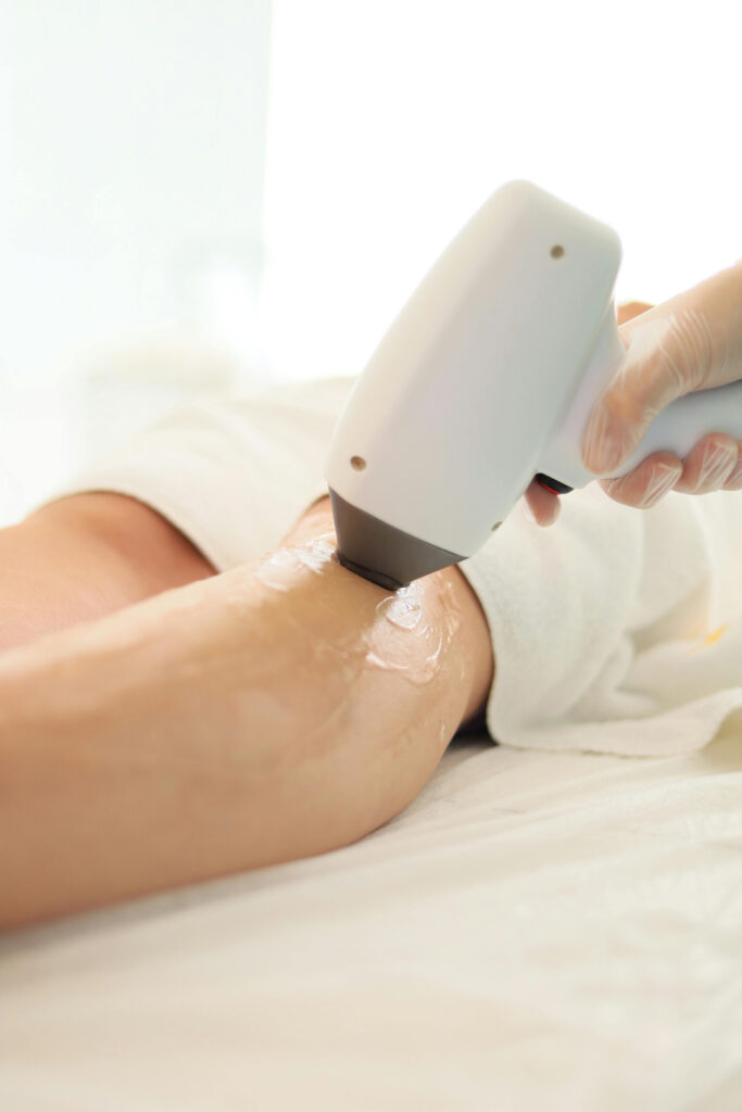 epilation-laser-medecine-esthetique-dr-derrien-montpellier